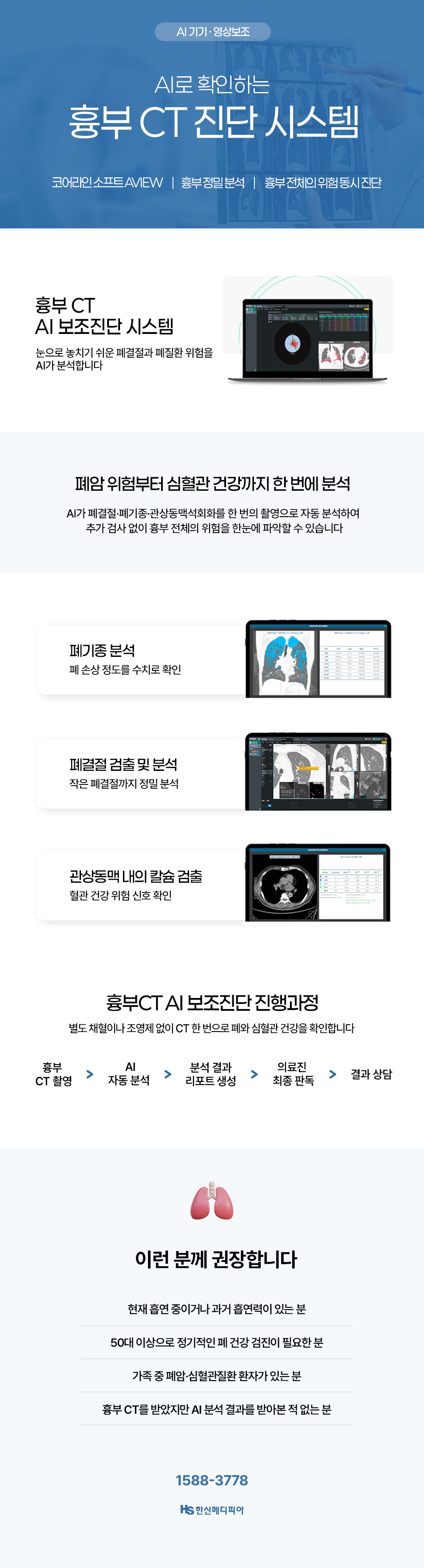 흉부 CT AI 보조진단